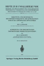 Erkennung Und Beurteilung Der Meniskusverletzung Des Kniegelenkes Durch Das Gewoehnliche Roentgenbild. Auswertung Und Dokumentation Traumatischer Wirb