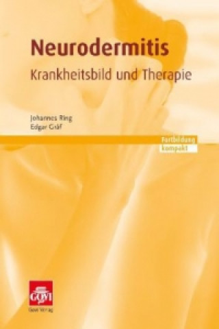 Neurodermitis - Krankheitsbild und Therapie