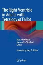 The Right Ventricle in Adults with Tetralogy of Fallot
