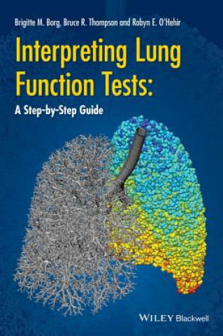 Interpreting Lung Function Tests - A Step-by-Step Guide