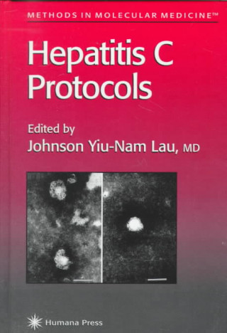 Hepatitis C Protocols