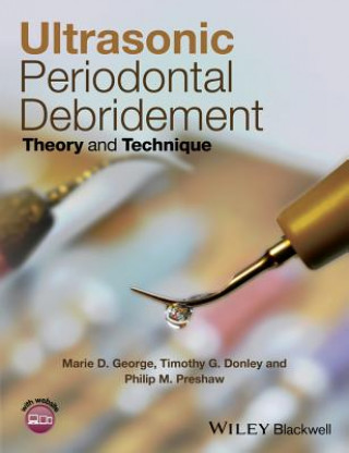 Ultrasonic Periodontal Debridement - Theory and Technique