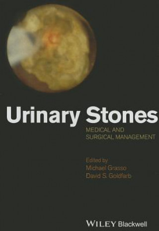 Urinary stones - Medical and Surgical Management
