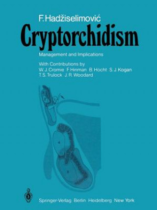 Cryptorchidism