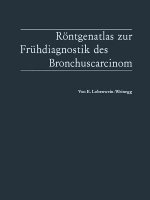 R ntgenatlas Zur Fr hdiagnostik Des Bronchuscarcinom
