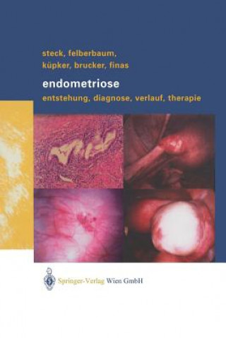 Endometriose