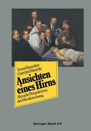 Ansichten Eines Hirns