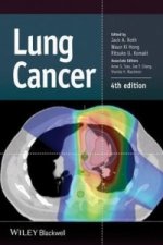 Lung Cancer 4e