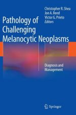 Pathology of Challenging Melanocytic Neoplasms