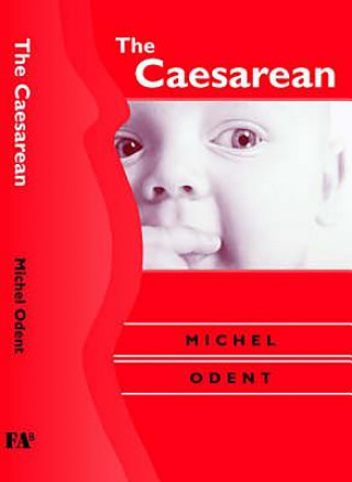 Caesarean