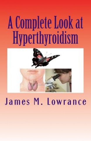 Complete Look at Hyperthyroidism