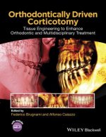 Orthodontically Driven Corticotomy - Tissue Engineering to Enhance Orthodontic and Multidisciplinary Treatment