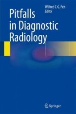 Pitfalls in Diagnostic Radiology