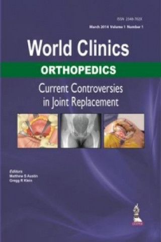 World Clinics: Orthopedics: Current Controversies in Joint Replacement