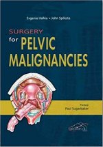 Surgery for Pelvic Malignances