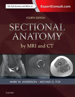 Sectional Anatomy by MRI and CT