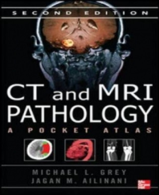 CT & MRI Pathology: A Pocket Atlas, Second Edition (Int'l Ed)