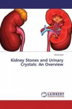 Kidney Stones and Urinary Crystals: An Overview