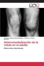 Anteromedializacion de la rotula en el adulto