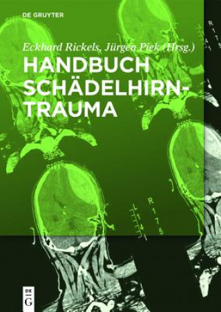 Handbuch Schadelhirntrauma