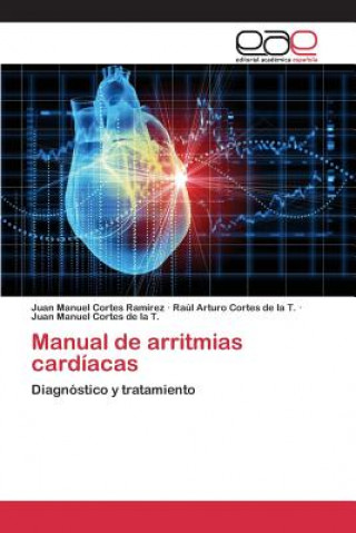 Manual de arritmias cardiacas