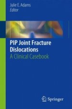 PIP Joint Fracture Dislocations