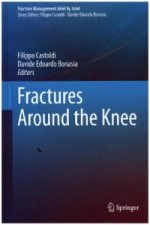 Fractures Around the Knee