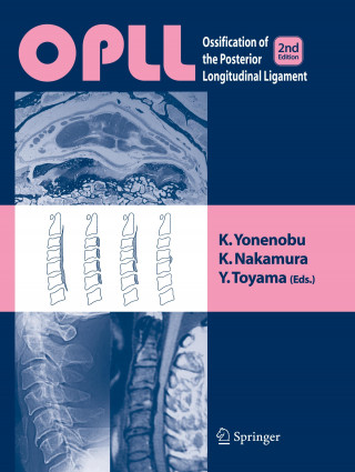 OPLL