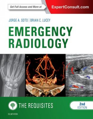 Emergency Radiology: The Requisites (Jorge Soto)(Pevná)