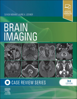 Brain Imaging (Laurie Loevner)(Kemény kötésű)