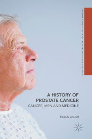 History of Prostate Cancer