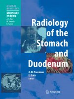 Radiology of the Stomach and Duodenum