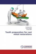 Tooth preparation for cast metal restorations