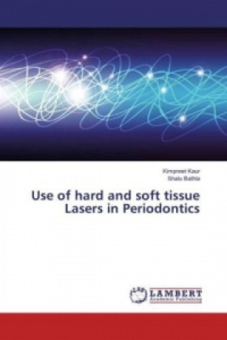 Use of hard and soft tissue Lasers in Periodontics