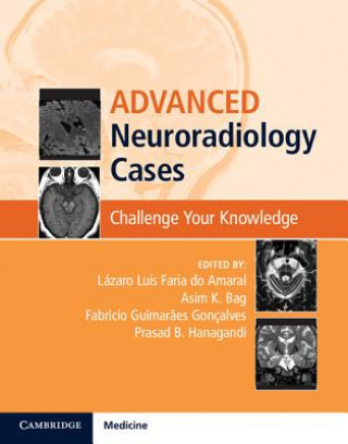 Advanced Neuroradiology Cases