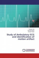 Study of Ambulatory ECG and identification of motion artifact