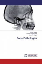 Bone Pathologies