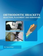 Orthodontic Brackets
