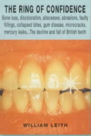British Teeth