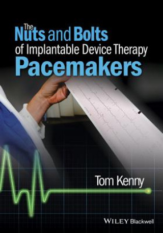 Nuts and Bolts of Implantable Device Therapy - Pacemakers