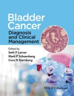 Bladder Cancer - Diagnosis and Clinical Management