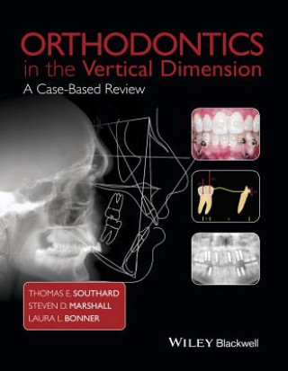 Orthodontics in the Vertical Dimension - A Case-Based Review