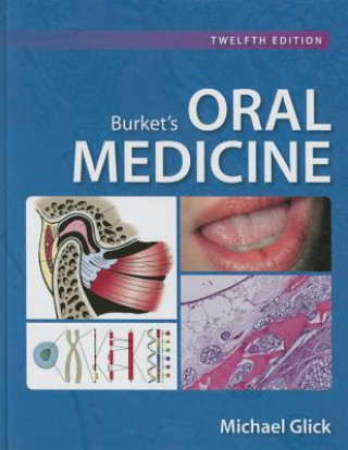 Burket's Oral Medicine
