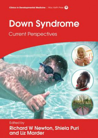 Down Syndrome - Current Perspectives
