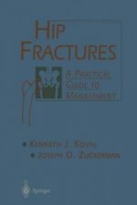 Hip Fractures