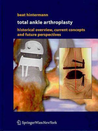 Total Ankle Arthroplasty