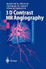 3D Contrast MR Angiography