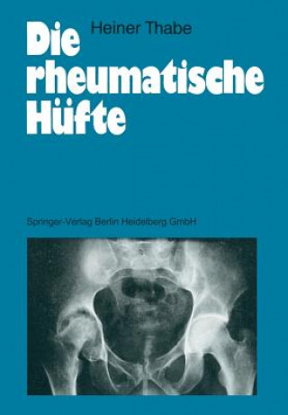 Die Rheumatische Hufte