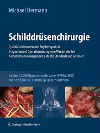 Schilddrusenchirurgie - Qualitatsindikatoren und Ergebnisqualitat, Diagnosen und Operationsstrategie im Wandel der Zeit, Komplikationsmanagement, aktu