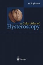Color Atlas of Hysteroscopy